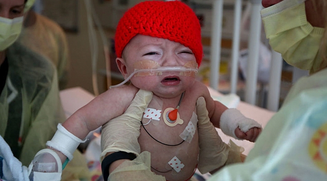 Türkiye'de her yıl yaklaşık 12 bin bebek doğuştan kalp hastalığı ile dünyaya geliyor