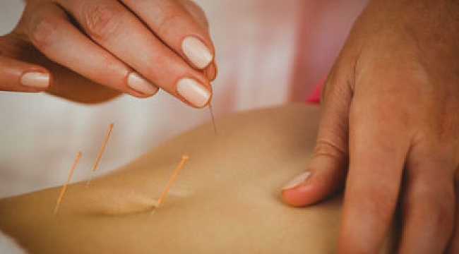 Akupunktur tek başına zayıflatır mı?