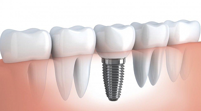 AKM'de dental sempozyumu gerçekleştirilecek