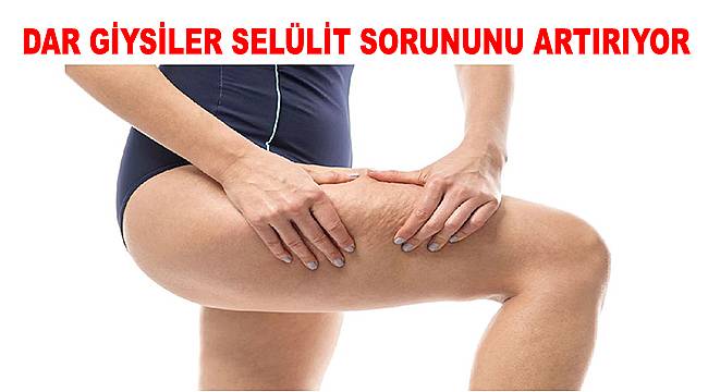 Kadınların korkulu rüyası: Selülit 