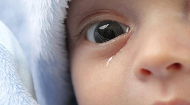 Bebeklerde görülen göz sulanması