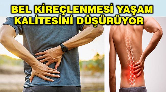 Bel kireçlenmesi nedir, nasıl tedavi edilir?