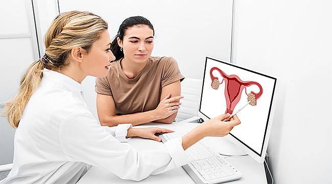 Çikolata kisti doğru tedavi edilmezse anne olmayı engelleyebilir