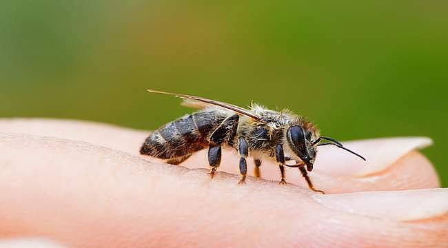 Böcek, sinek ve arı sokması: Belirtiler, yapılması gerekenler ve tedavi...