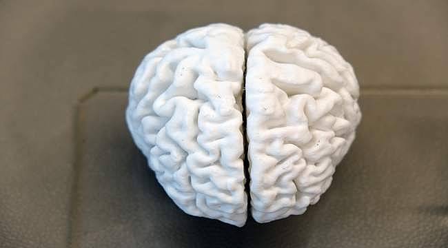 Türkiye'de bir ilk gerçekleşti: "Yaşayan bir insan beyninin 3D kopyası yapıldı"