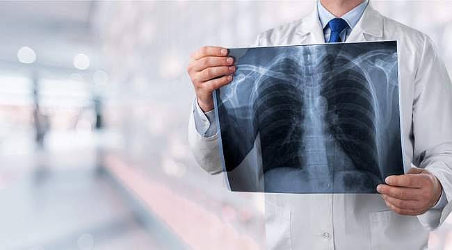 Akciğer kanseri ameliyatlarında etkinliği kanıtlanmış yöntem: Tek Port VATS 