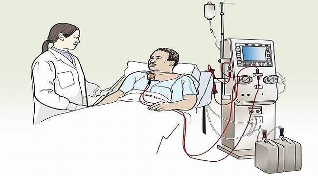 Diyaliz tedavisi görenler bu önerilere kulak verin!