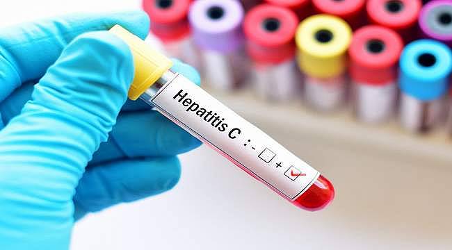 Hepatit virüslerinin belirtileri ve etkileri 